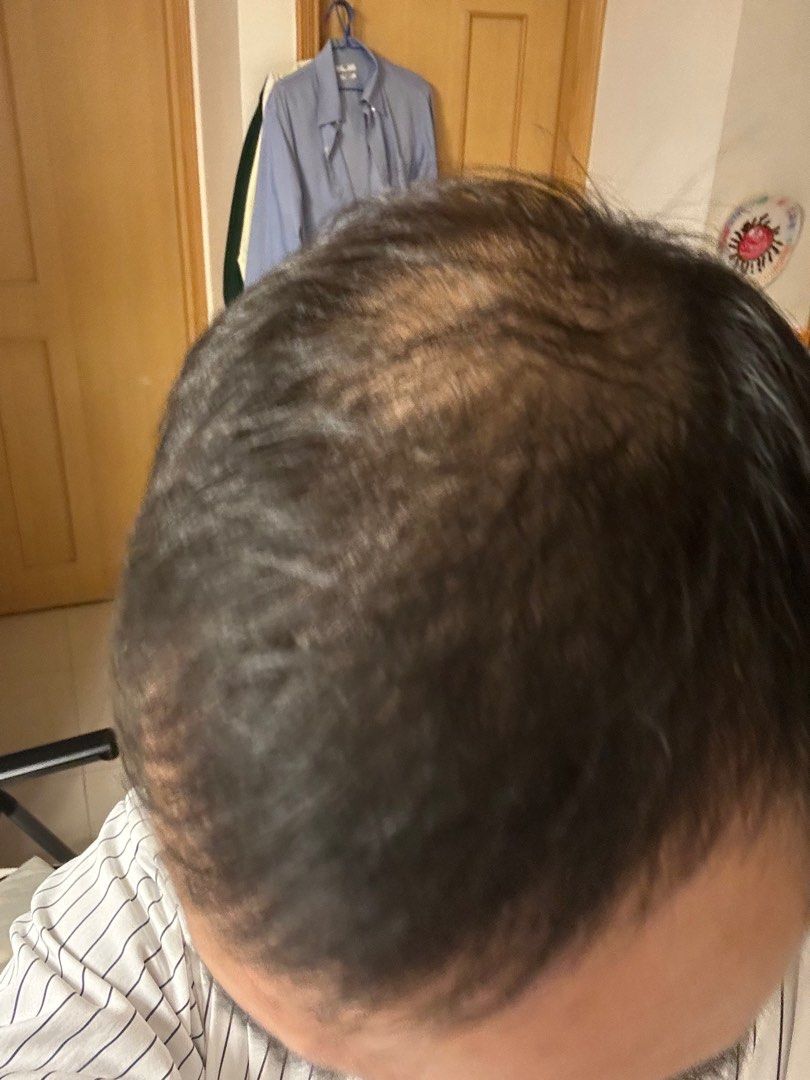 使用 DARKO 三個月後的頭髮狀況